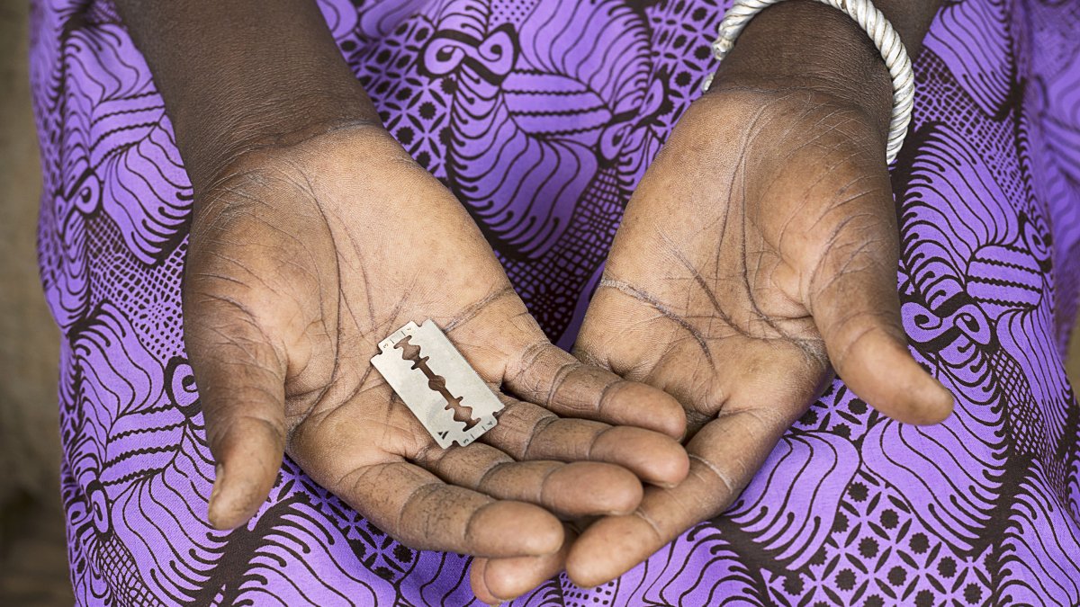 FGM