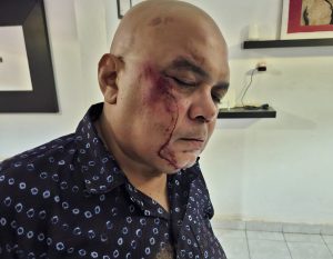 Guinea-Bissau: Attack on RTP-Africa Journalist Sparks Condemnation and Raises Press Freedom Concerns