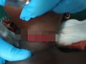 Gunjur Child Assault: Police Arrest Three Over Knife Attack on Toddler